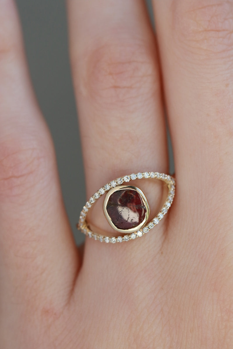 Trapiche Ruby Eye Ring with Diamond Halo